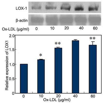 OxLDL Increases The Expression Of LOX1 Protein OxLDL Protein