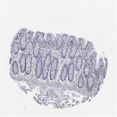 Tissue Expression Of ODC1 Staining In Colon The Human Protein Atlas