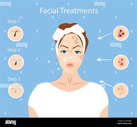 Vector Of A Young Woman With Face Imperfections Facial Treatments