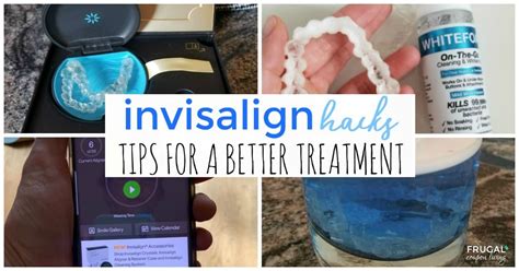 16 Invisalign Hacks and Tips To Make Your Treatment Better