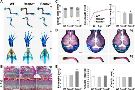 Skeletal Development And Growth In Rcan2 Ϫ Ϫ Mice A Upper And Lower