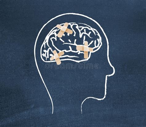 Brain Jigsaw Puzzle Stock Photo Image Of Forget Concept 34242532