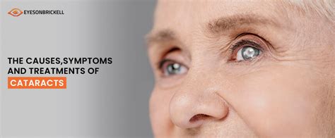 Cataracts Symptoms