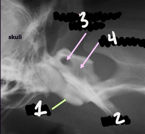 Radiology Of Spine And Skill Anatomy Exam 3 Flashcards Quizlet