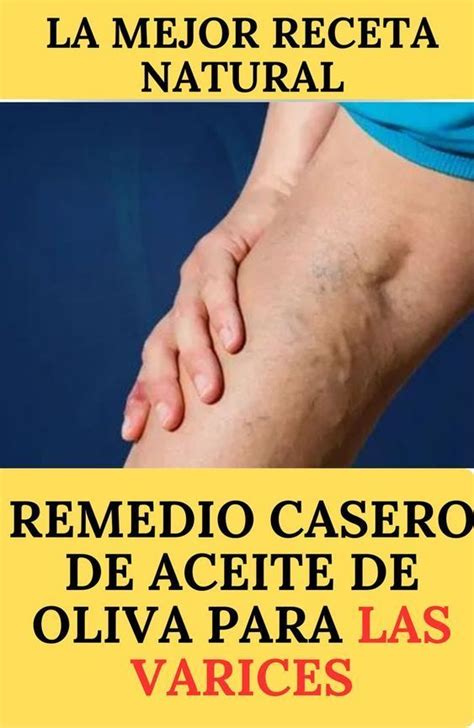 Remedios Caseros Para Eliminar Las Varices Gruesas Psoriasis Varicose