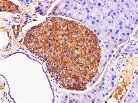 Chromogranin A Polyclonal Antibody 专业科研用生物实验试剂生产商 Elabscience 官方网站