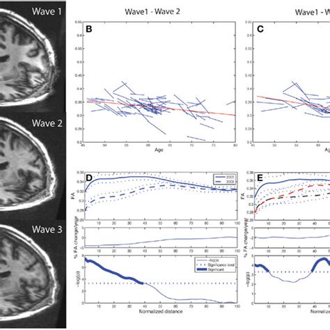 Three Dimensional Visualisation Of Diffusion Tensor Tractography