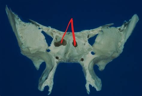 The Skeletal System Sphenoid Ethmoid And Temporal Flashcards Quizlet