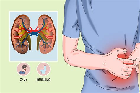 腎功能衰竭 求真百科