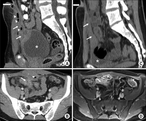 A Sagittal Computed Tomography Ct Image Of The Abdomen And Pelvis Download Scientific