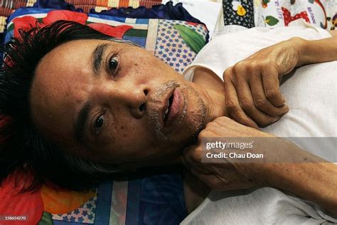 Vietnamese Veteran And Agent Orange Victim Nguyen Van Diem 64 Diem