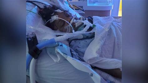 Teen Girl Recovering A Month After Being Struck By Hit And Run Driver