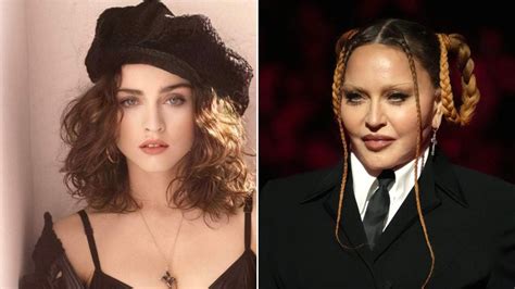 MADONNA ANTES E DEPOIS Aparência da rainha do pop é alvo de críticas