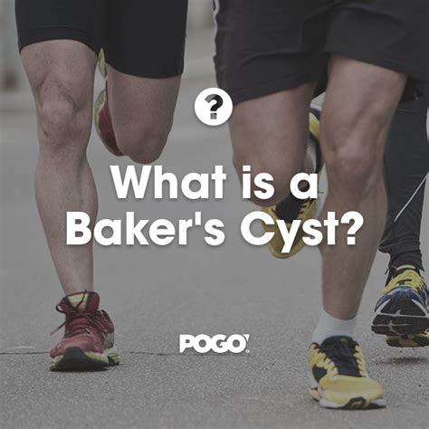 What is a Baker's Cyst? | POGO Physio Gold Coast