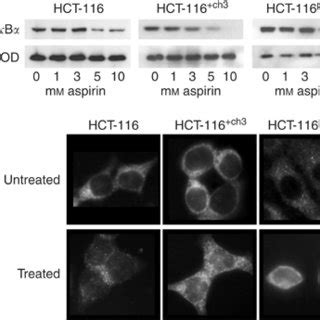 Effect Of Aspirin On Cell Viability And Apoptosis In Colorectal Cancer