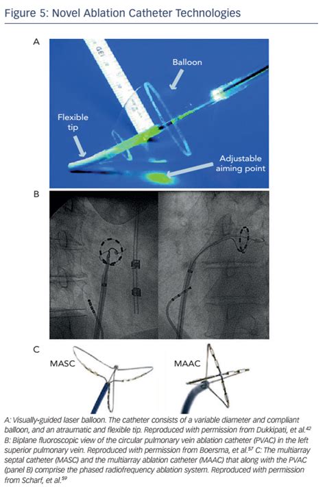 Novel Interventional Strategies For The Treatment Of Atrial