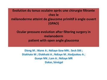 Chirurgie Filtrante Glaucome