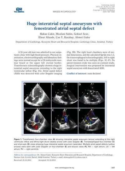 Huge Interatrial Septal Aneurysm With Fenestrated Atrial Septal Defect