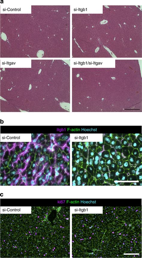 Histological Analysis Of Livers After Knockdown Of Integrins In Adult