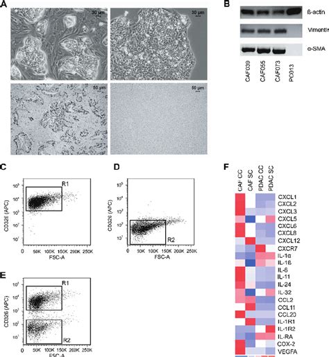 Figure W Characterization Of Primary Pdac And Caf Cell Lines