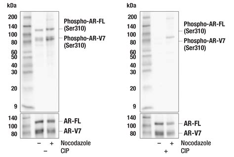 Phospho Androgen Receptor Ser E L S Rabbit Mab Cell Signaling