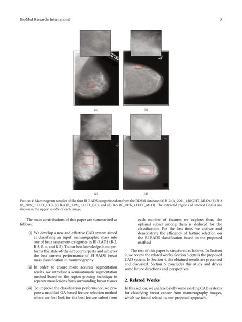 A New Computer Aided Diagnosis System With Modified Genetic Feature