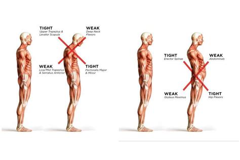 Whats Your Posture And What Does It Mean