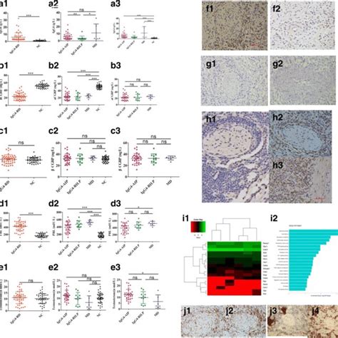 Immune Response Induced By CGRP Deficiency Macrophages Can Be Observed