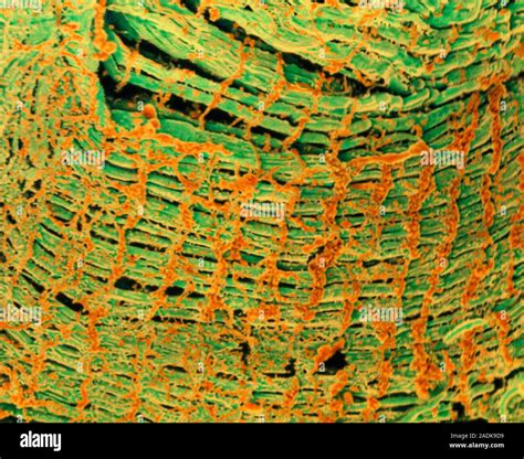 Striated Muscle Coloured Scanning Electron Micrograph Sem Of Human