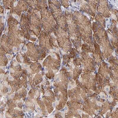 IF3EI Antibody NBP1 87955 By Novus Part Of Bio Techne