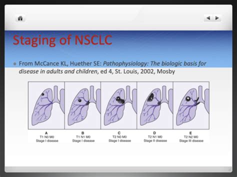 Lung Cancer Flashcards Quizlet