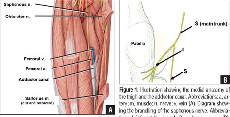 Figure 1 From Saphenous And Infrapatellar Nerves At The Adductor Canal Anatomy And Implications