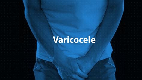 Varicocele Youtube