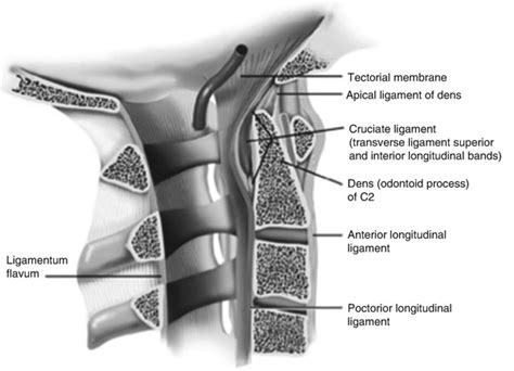 Craniovertebral Junction Spine Surgery Cess Center Of Excellence In Spine Surgery