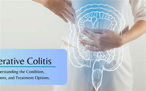 Understanding Ulcerative Colitis Symptoms Causes And Treatment Nbkomputer