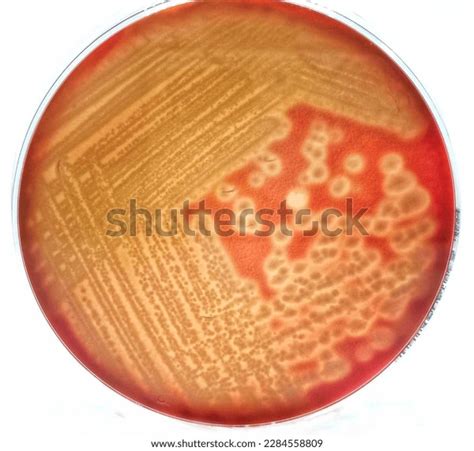 Beta Hemolysis Bacterial Colonies On Sheep Stock Photo 2284558809 ...