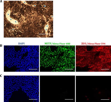 A Optical Microscope Image Of Hesc Rpe Cells On Dham Locked Into The