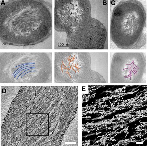 Morphology Of The Dna Dps Liquid Crystalline Assemblies In Dormant E