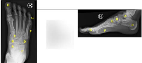 Foot X Ray Diagram Quizlet