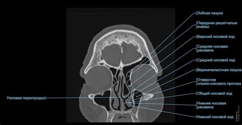 Голова KT : нормальная анатомия | e-Anatomy