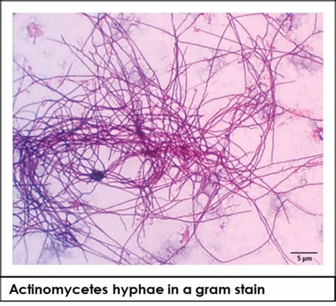 Actinomyces Branching Gram Pos Rods Flashcards Quizlet