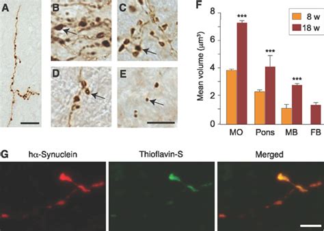 Caudorostral brain spreading of αsynuclein through vagal connections