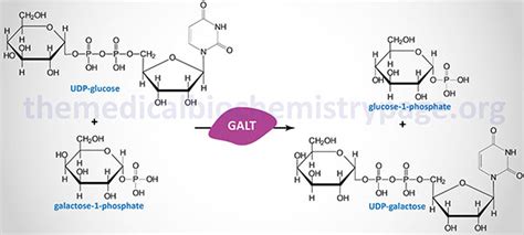 Galactose Metabolism Disorders The Medical Biochemistry Page