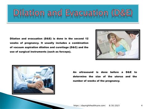 PPT - Dilation and Evacuation – Surgical Abortion Procedure PowerPoint ...