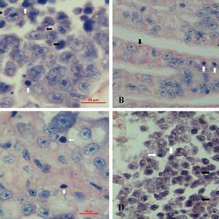 A Healthy L Vannamei With Dark Coloured Hepatopancreas And Gut B