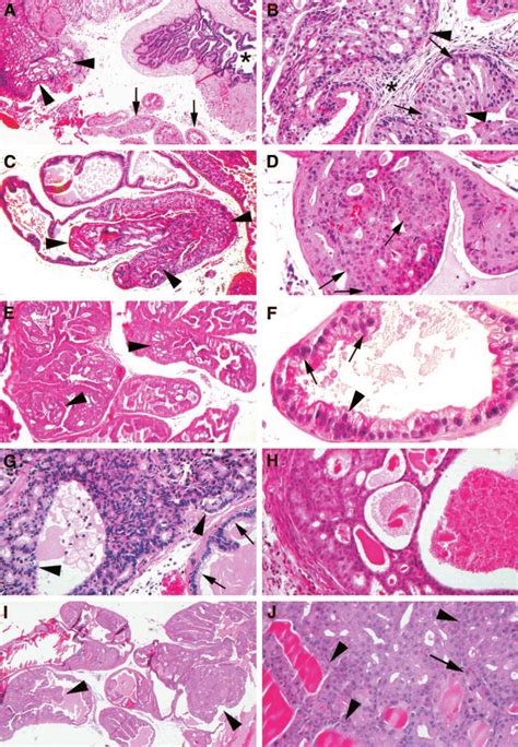 Prostatic Intraepithelial Neoplasia Pin In Non Sv40tag Mouse Models