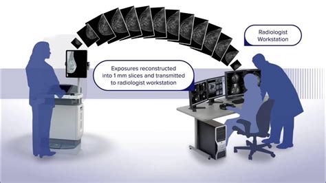 The Genius™ 3d Mammography™ Exam How It Works Youtube