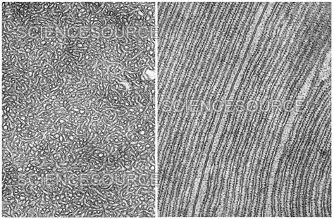 Smooth And Rough Endoplasmic Reticulum Stock Image Science Source