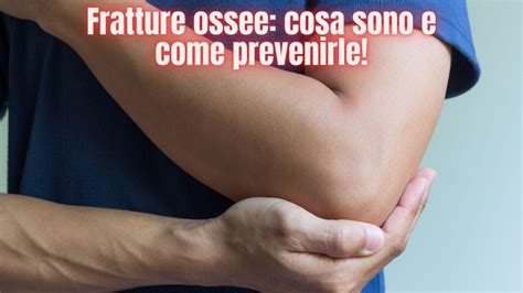 Fratture Ossee Cosa Sono E Come Prevenirle Per Restare In Salute