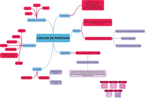 Cancer De Prostata Mapa Conceptual Tesmapa Porn Sex Picture